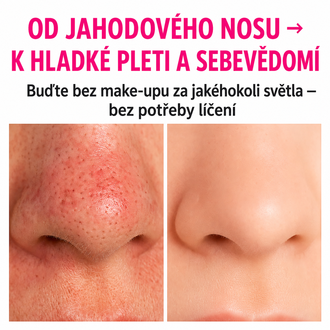 PoreClean: Vakuový Vysavač Pórů